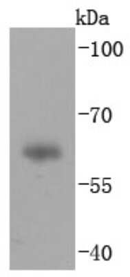 Western Blot: IgA Antibody (JM10-42) [NBP2-66901]