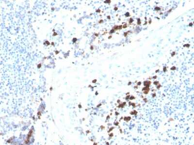 Immunohistochemistry-Paraffin: IgA Antibody (rHISA43) - Azide and BSA Free [NBP3-08604]