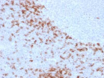 Immunohistochemistry-Paraffin: IgD Antibody (IgD26) - Azide and BSA Free [NBP3-08605]