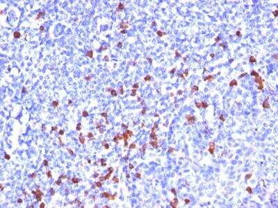 Immunohistochemistry-Paraffin: IgG Antibody (SPM556) - IHC-Prediluted [NBP2-48228]