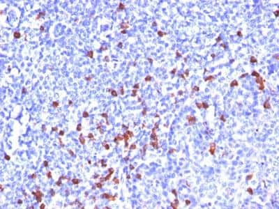 Immunohistochemistry-Paraffin: IgG Antibody (SPM556) [NBP2-34381]