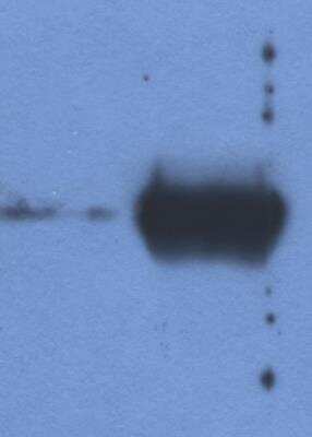 Western Blot: IgG Light Chain Antibody (IVA285-1) [NBP2-62190]