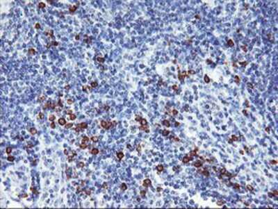 Immunohistochemistry-Paraffin: IgJ Antibody (OTI3B3) [NBP2-01688]