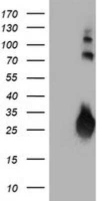 Western Blot: IgJ Antibody (OTI3B3) [NBP2-01688]