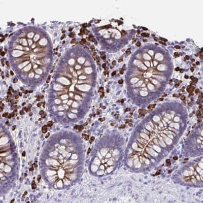 Immunohistochemistry-Paraffin: IgJ Antibody [NBP2-38523]