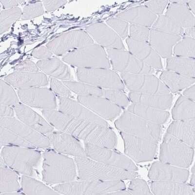 Immunohistochemistry-Paraffin: IgJ Antibody [NBP2-38523]