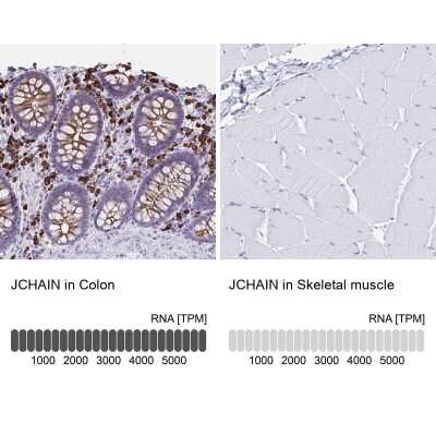 Immunohistochemistry-Paraffin: IgJ Antibody [NBP2-38523]