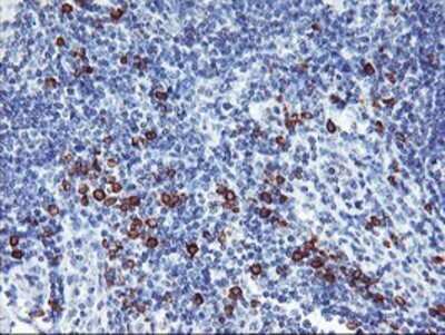 Immunohistochemistry: IgJ Antibody (OTI3B3) - Azide and BSA Free [NBP2-71016]