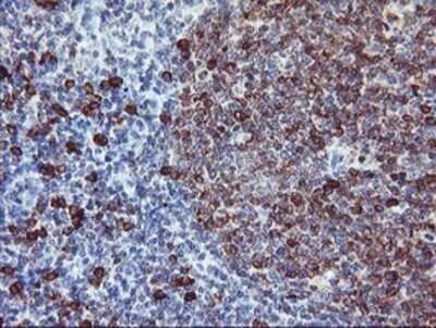 Immunohistochemistry: IgJ Antibody (OTI3B3) - Azide and BSA Free [NBP2-71016]