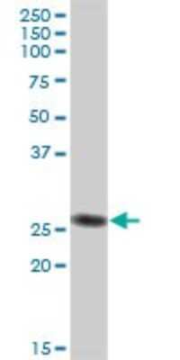 Western Blot: IgL Antibody [H00003535-B01P]