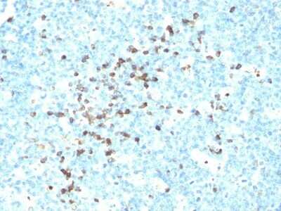 Immunohistochemistry-Paraffin: IgM Antibody (DA4-4 (same as SA-DA4 or HB57)) - IHC-Prediluted [NBP2-45056]