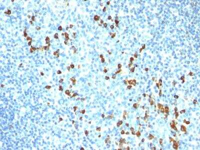 Immunohistochemistry-Paraffin: IgM Antibody (ICO-30) - IHC-Prediluted [NBP2-48239]