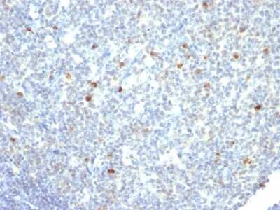 Immunohistochemistry-Paraffin: IgM Antibody (IM260) - IHC-Prediluted [NBP2-45057]