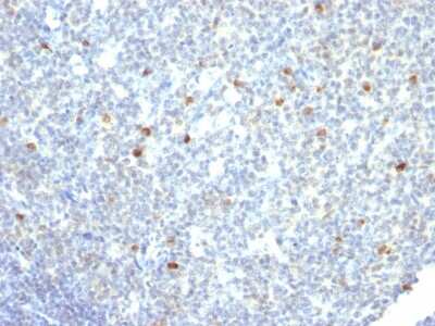 Immunohistochemistry-Paraffin: IgM Antibody (IM260) [NBP2-34253]
