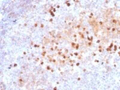 Immunohistochemistry-Paraffin: IgM Antibody (IM373) - IHC-Prediluted [NBP2-45059]