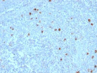 Immunohistochemistry-Paraffin: IgM Antibody (IM373) [NBP2-34254]