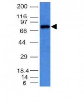 Western Blot: IgM Antibody (IM373) [NBP2-34254]