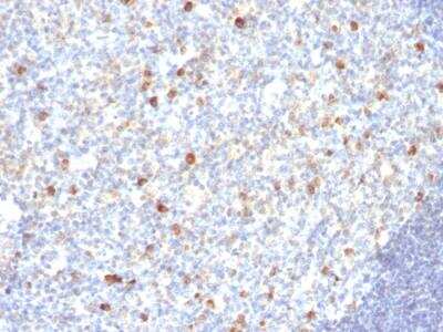 Immunohistochemistry-Paraffin: IgM Antibody (SPM188) - IHC-Prediluted [NBP2-48240]