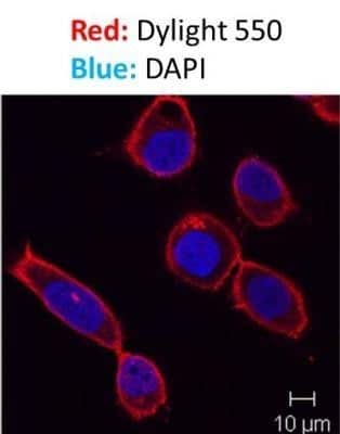 Immunocytochemistry/ Immunofluorescence: IgM Antibody (SPM557) - Azide and BSA Free [NBP2-34422]