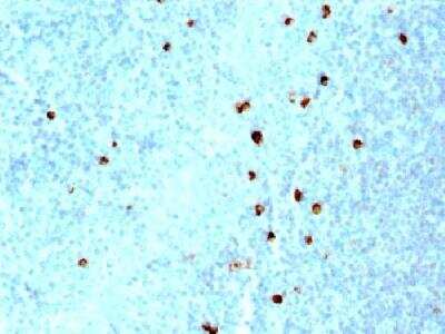 Immunohistochemistry-Paraffin: IgM Antibody (SPM557) - Azide and BSA Free [NBP2-34422]