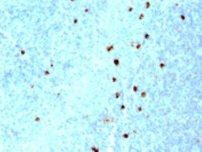 Immunohistochemistry-Paraffin: IgM Antibody (SPM557) [NBP2-34375]
