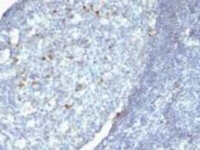 Immunohistochemistry-Paraffin: IgM Heavy Chain Antibody (Cocktail) [NBP2-47255]