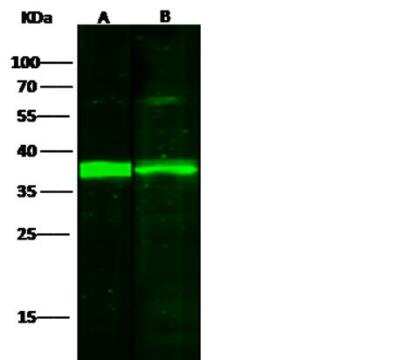 Western Blot: IkB-alpha Antibody (116) [NBP2-90043]