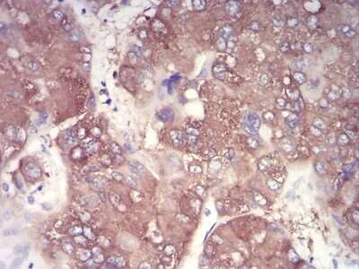 Immunohistochemistry-Paraffin: IkB-alpha Antibody (4D4C4) - BSA Free [NBP2-52517]