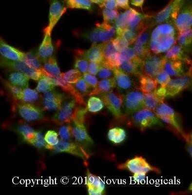 Immunocytochemistry/ Immunofluorescence: IkB-alpha Antibody (6A920) - Azide and BSA Free [NBP2-80787]