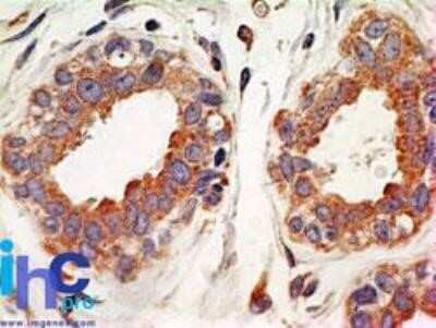 Immunohistochemistry: IkB-alpha Antibody (6A920) - Azide and BSA Free [NBP2-80787]