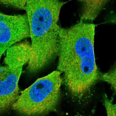 Immunocytochemistry/ Immunofluorescence: IkB-alpha Antibody [NBP1-87761]