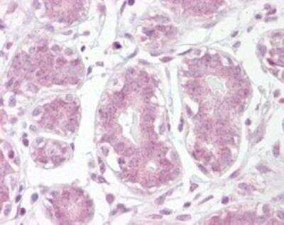 Immunohistochemistry-Paraffin: IkB-alpha Antibody [NB120-22071]