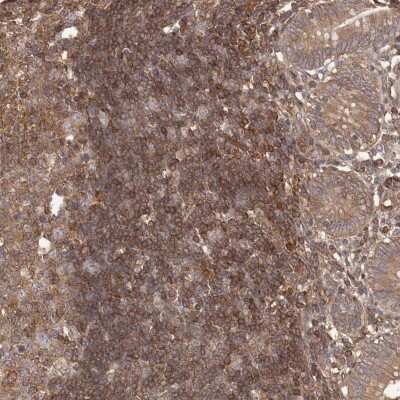 Immunohistochemistry-Paraffin: IkB-alpha Antibody [NBP1-87761]