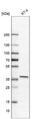 Western Blot: IkB-alpha Antibody [NBP1-87761]