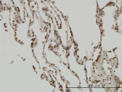 Immunohistochemistry-Paraffin: IkB-beta Antibody (1B5) [H00004793-M01]