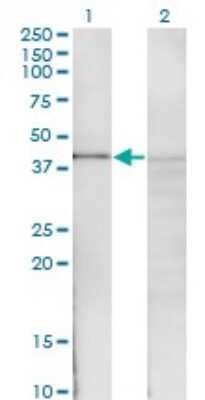 Western Blot: IkB-beta Antibody (1G6) [H00004793-M06]