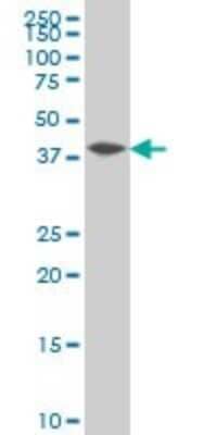 Western Blot: IkB-beta Antibody (2B11) [H00004793-M02]