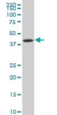 Western Blot: IkB-beta Antibody (3B5) [H00004793-M04]