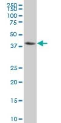 Western Blot: IkB-beta Antibody (3E11) [H00004793-M03]