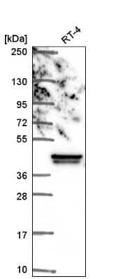 Western Blot: IkB-beta Antibody [NBP2-57108]