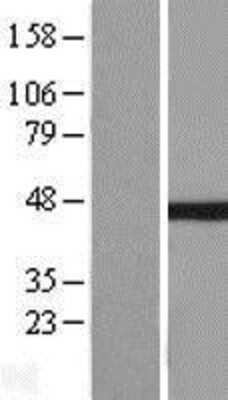 Western Blot: IkB-beta Overexpression Lysate [NBL1-13621]