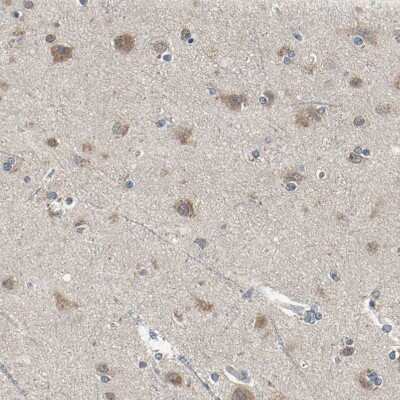 Immunohistochemistry-Paraffin: IkB-epsilon Antibody [NBP1-87762]