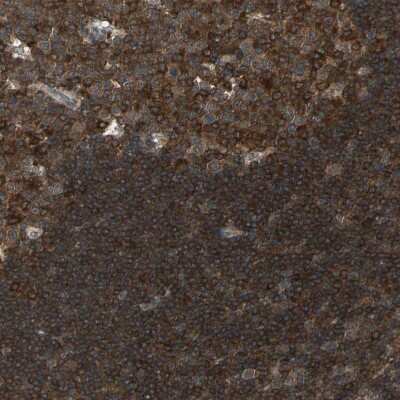 Immunohistochemistry-Paraffin: IkB-epsilon Antibody [NBP1-87762]