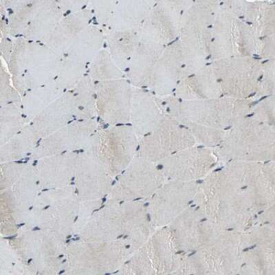 Immunohistochemistry-Paraffin: IkB-epsilon Antibody [NBP1-87762]