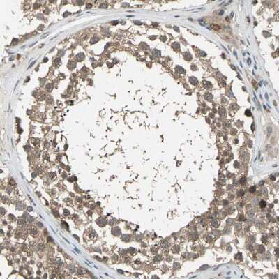 Immunohistochemistry-Paraffin: IkB-epsilon Antibody [NBP1-87762]