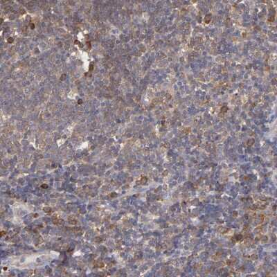 Immunohistochemistry-Paraffin: IkB-epsilon Antibody [NBP1-87763]