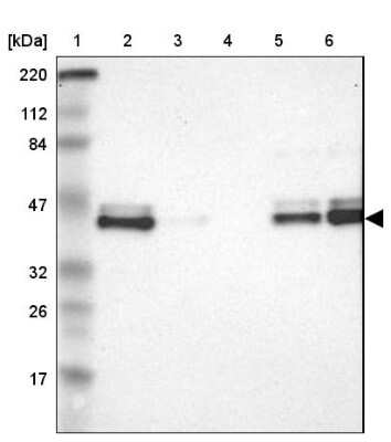 Western Blot: IkB-epsilon Antibody [NBP1-87762]