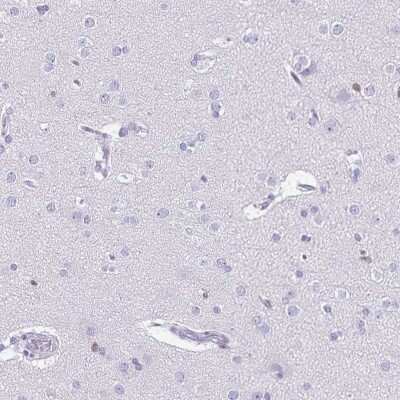 Immunohistochemistry-Paraffin: Ikaros/IKZF1 Antibody [NBP2-38241]