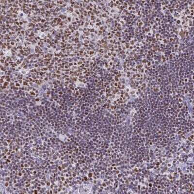 Immunohistochemistry-Paraffin: Ikaros/IKZF1 Antibody [NBP2-38241]