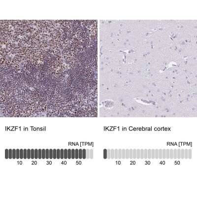 Immunohistochemistry-Paraffin: Ikaros/IKZF1 Antibody [NBP2-38241]